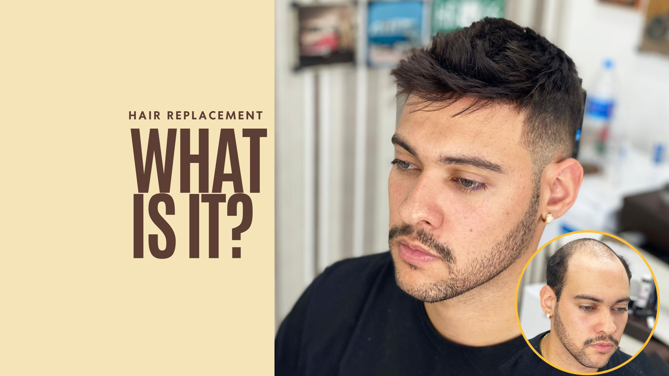 Hair System Replacement: Origins, Advantages & Everything You Should Know