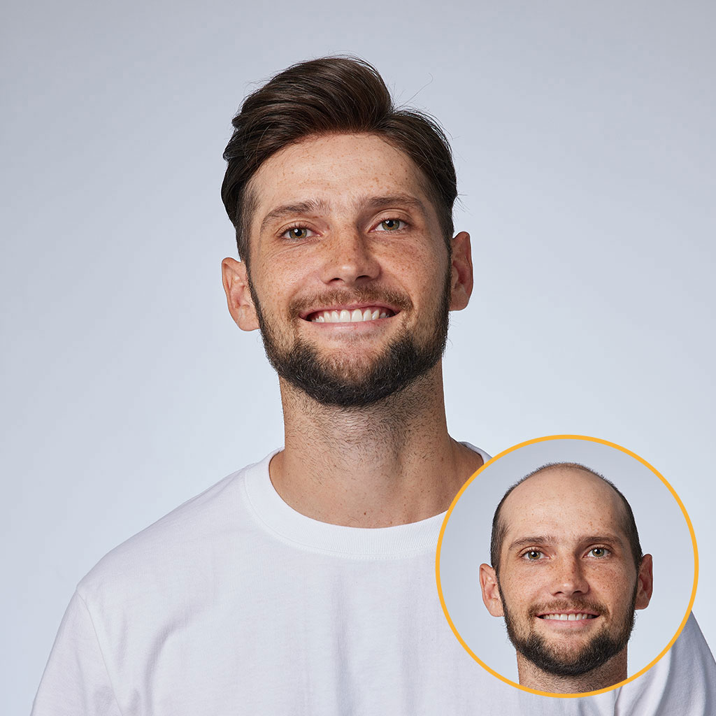 Classic Poli Hair System - Strandly Hair